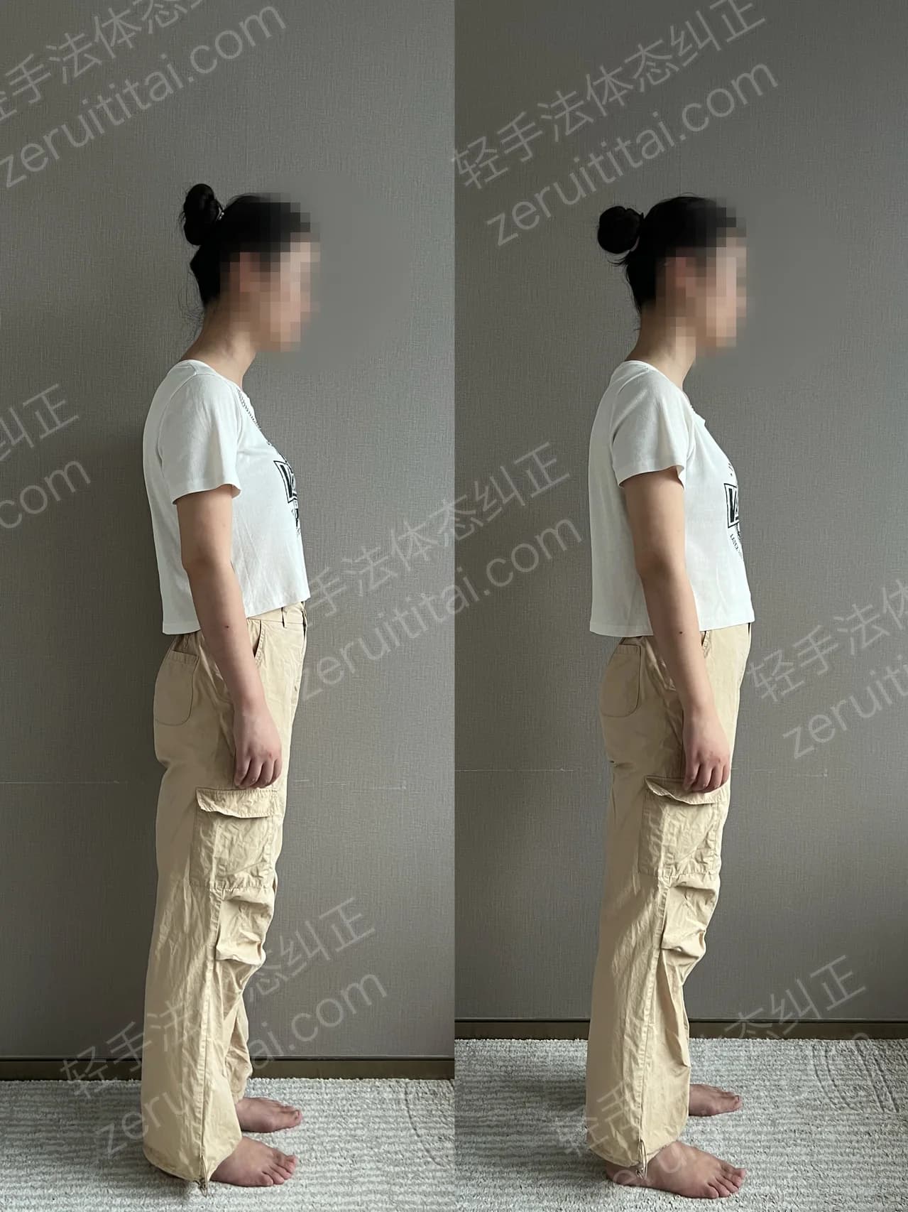 单次矫正案例对比 155