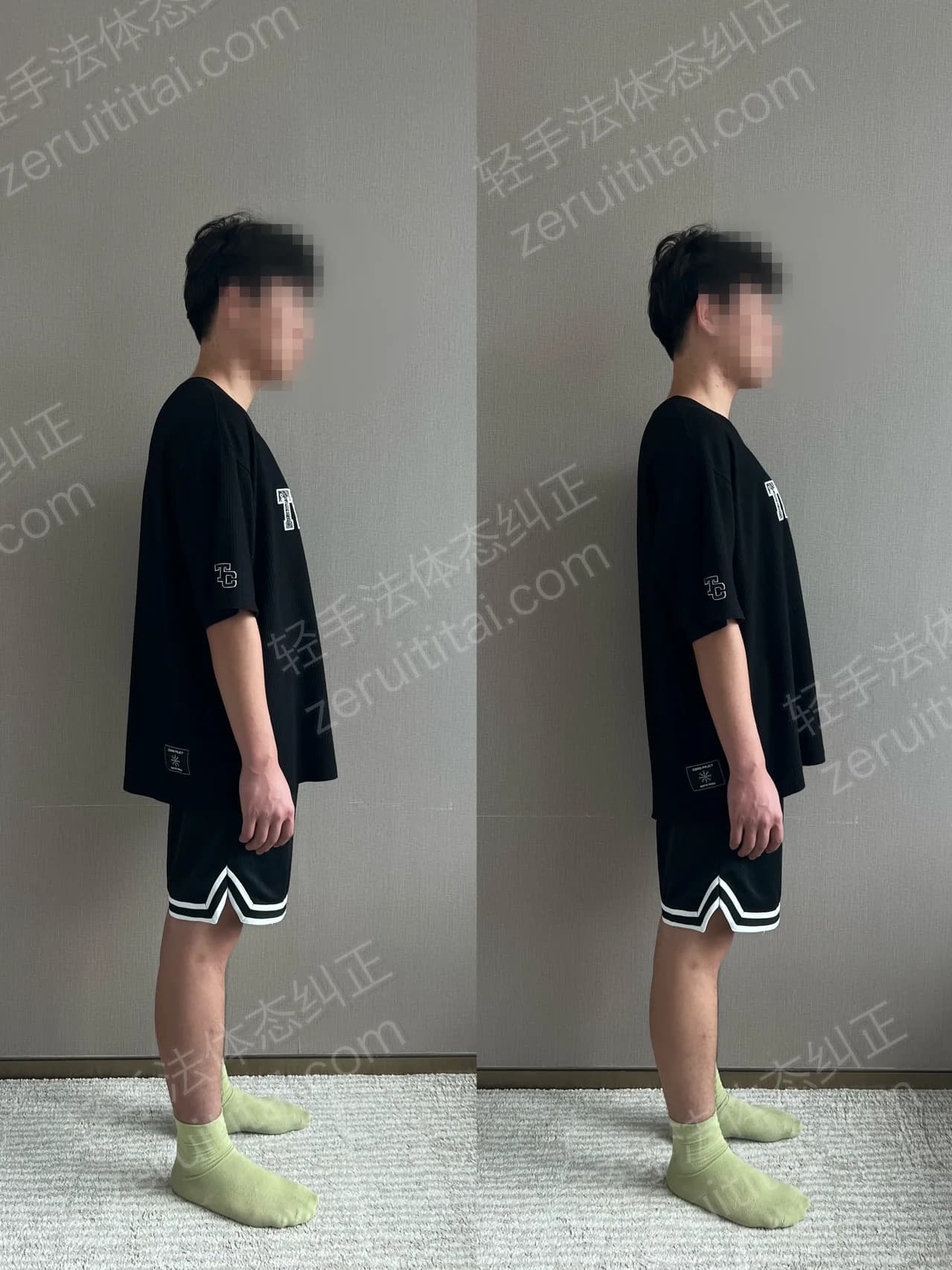 单次矫正案例对比 157