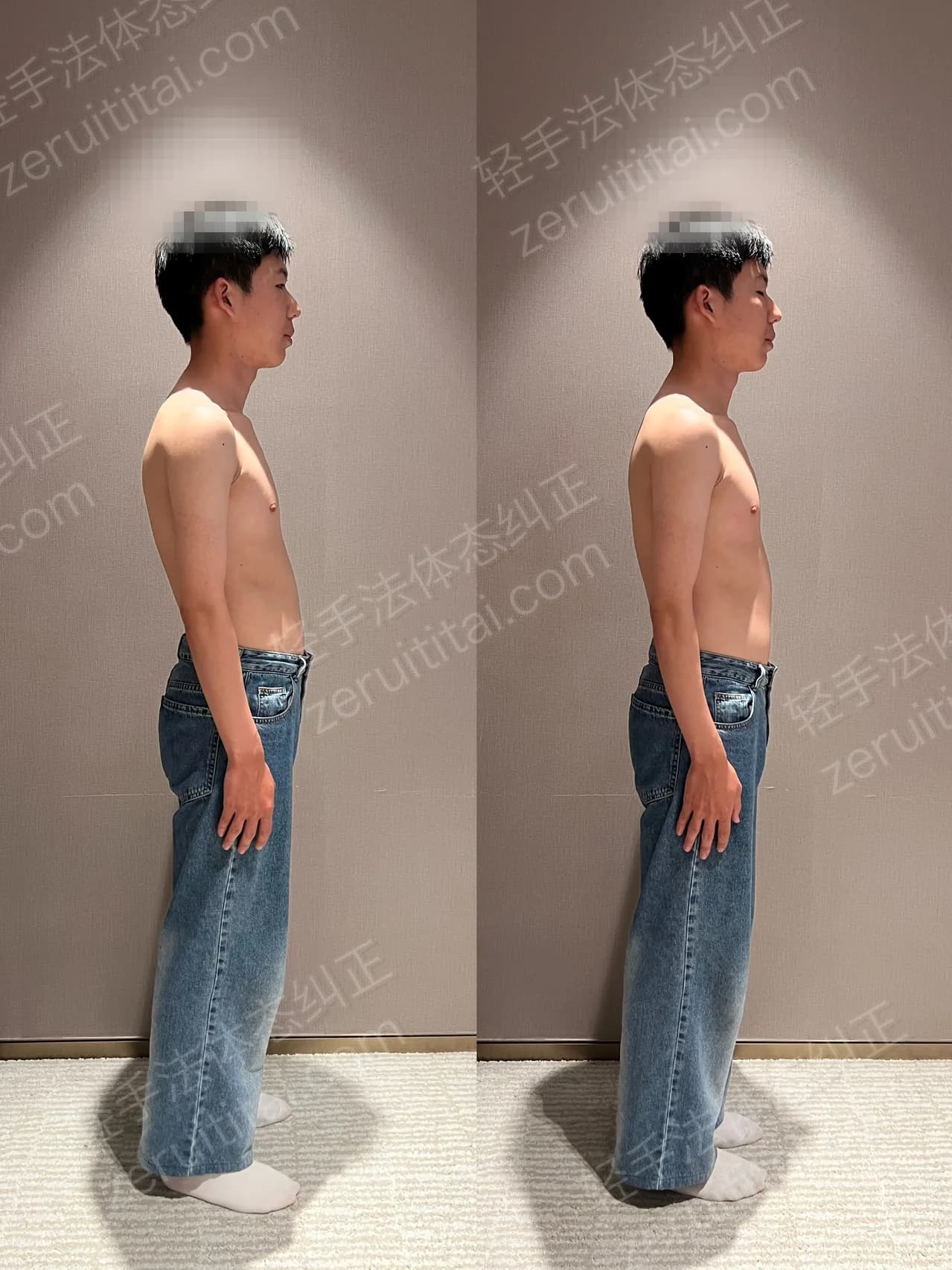 单次矫正案例对比 160