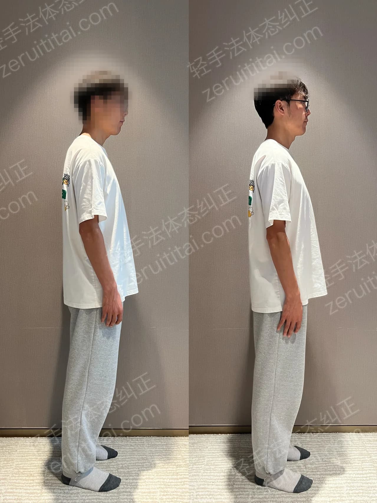 单次矫正案例对比 162