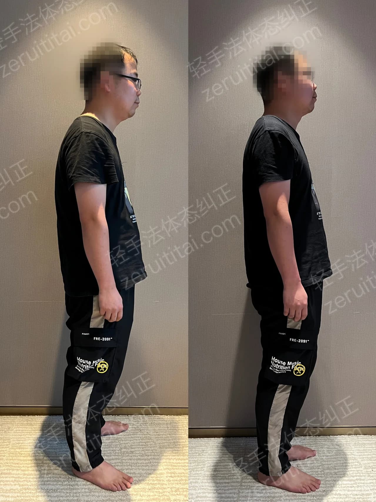 单次矫正案例对比 165