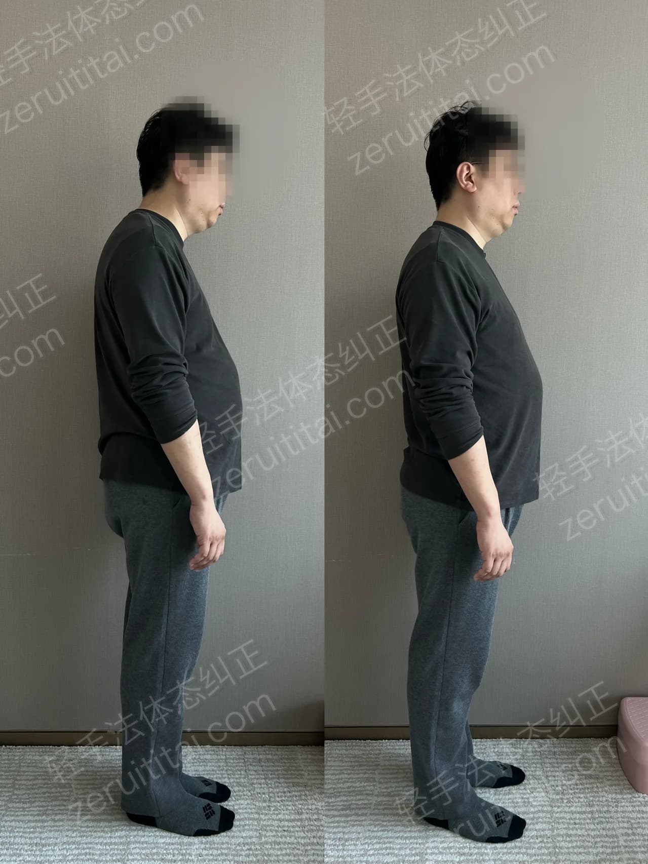 单次矫正案例对比 168