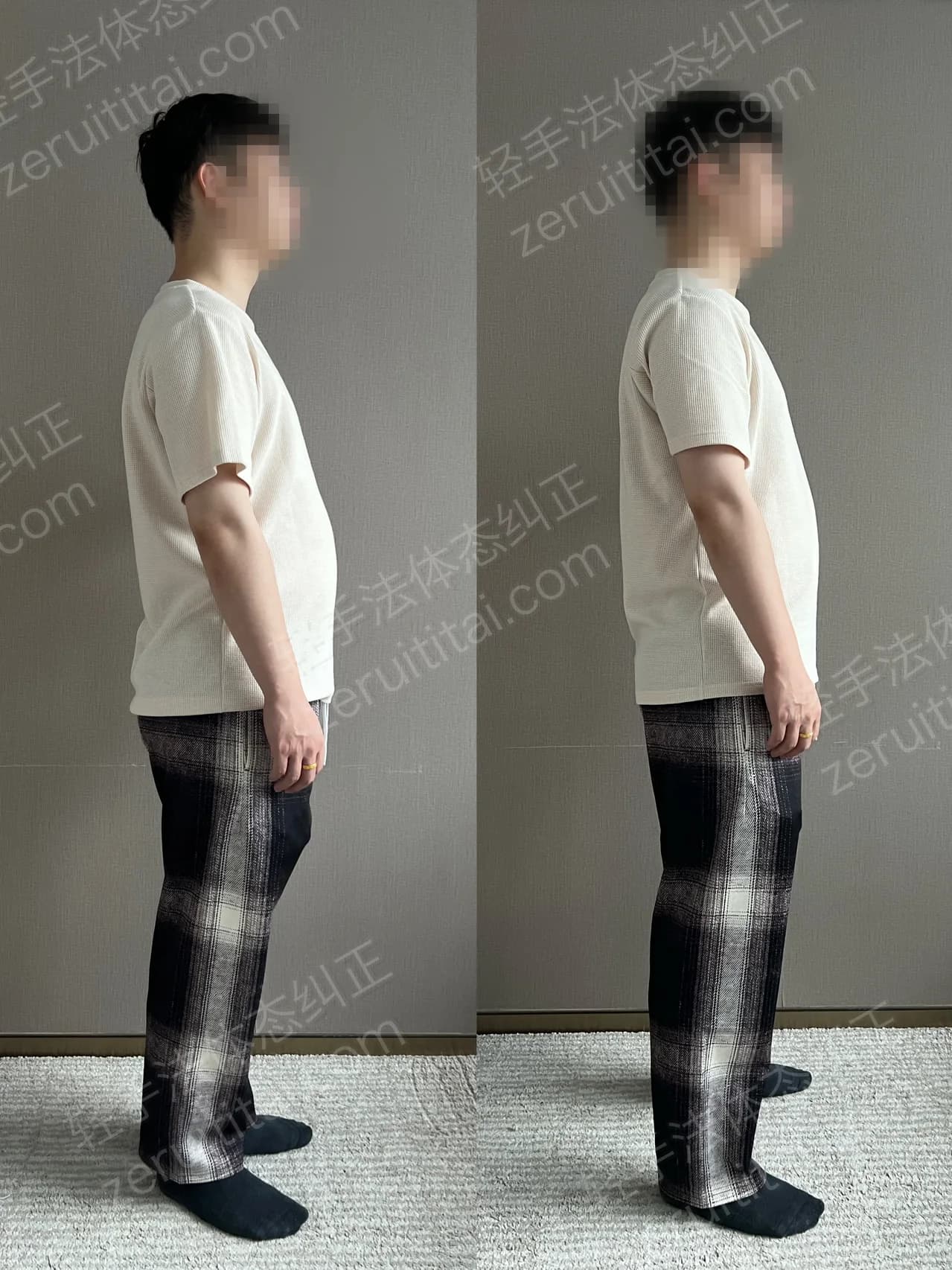 单次矫正案例对比 169