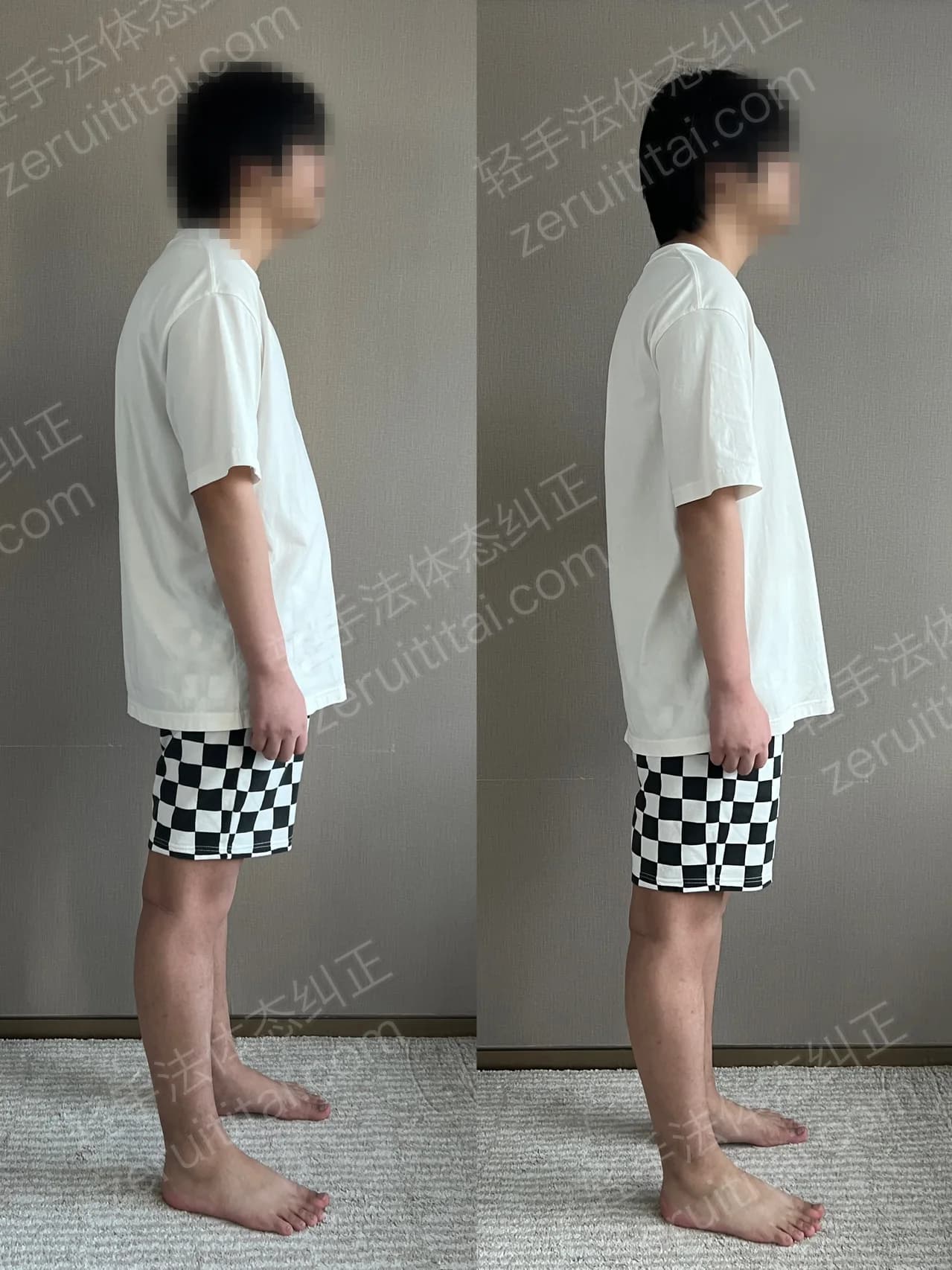 单次矫正案例对比 173