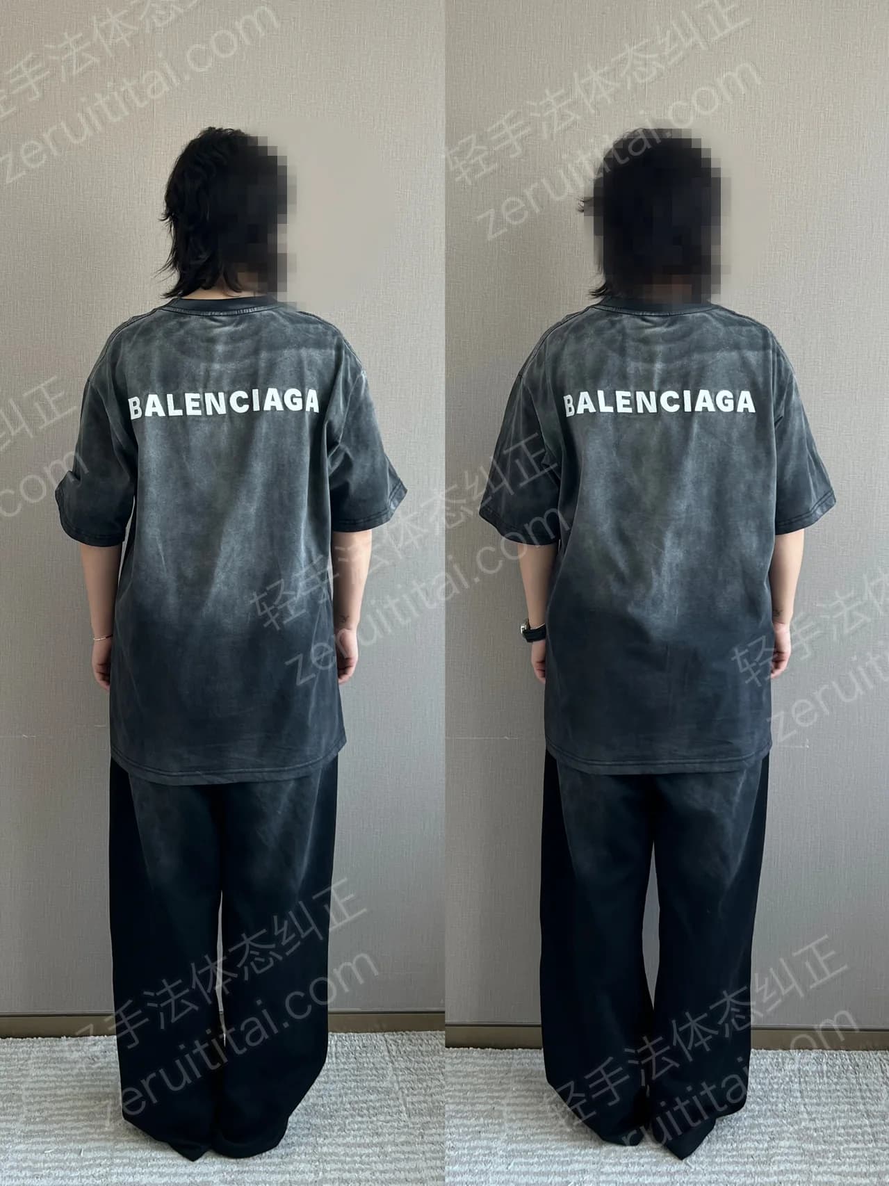 单次矫正案例对比 179