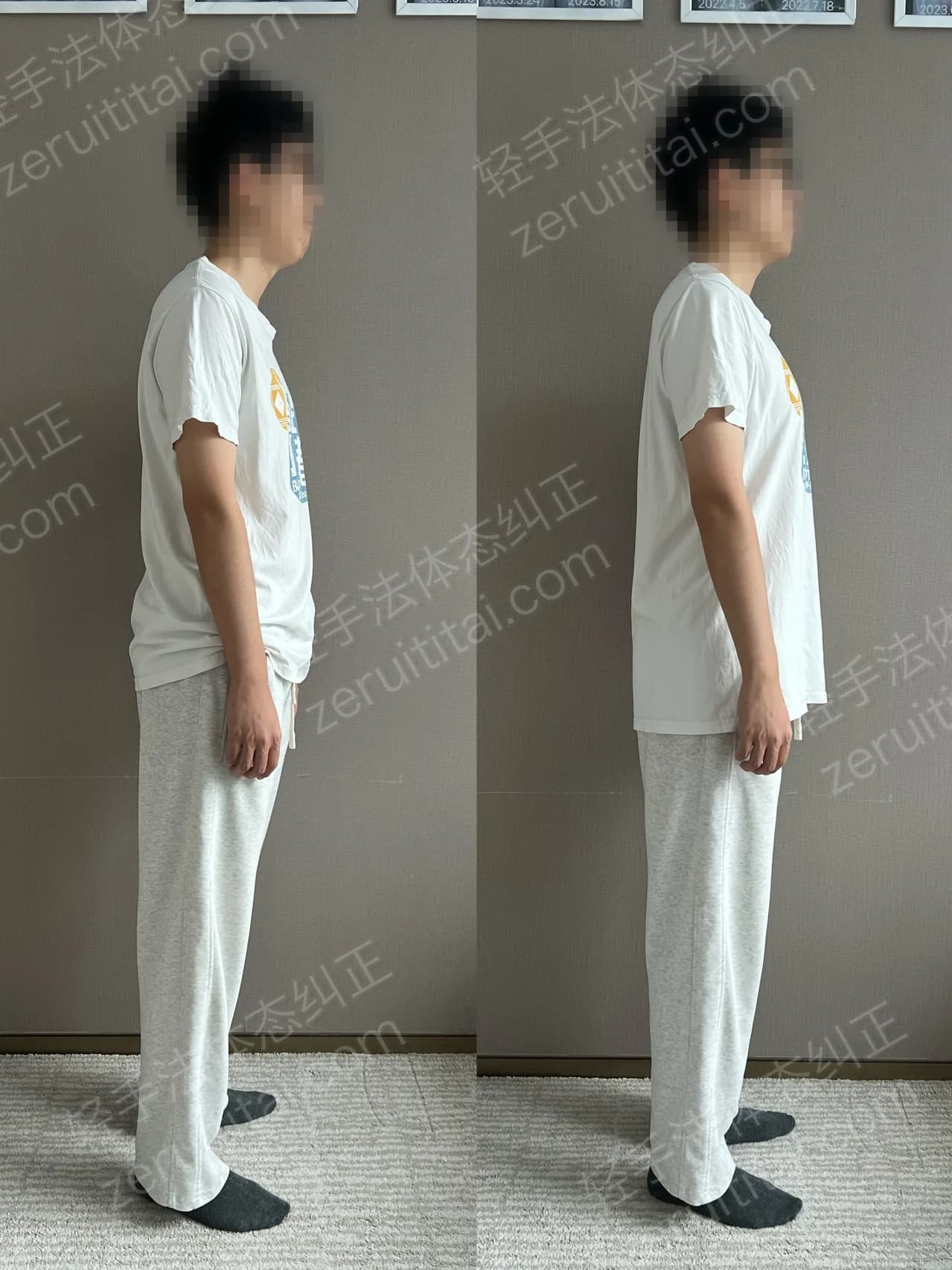 单次矫正案例对比 181