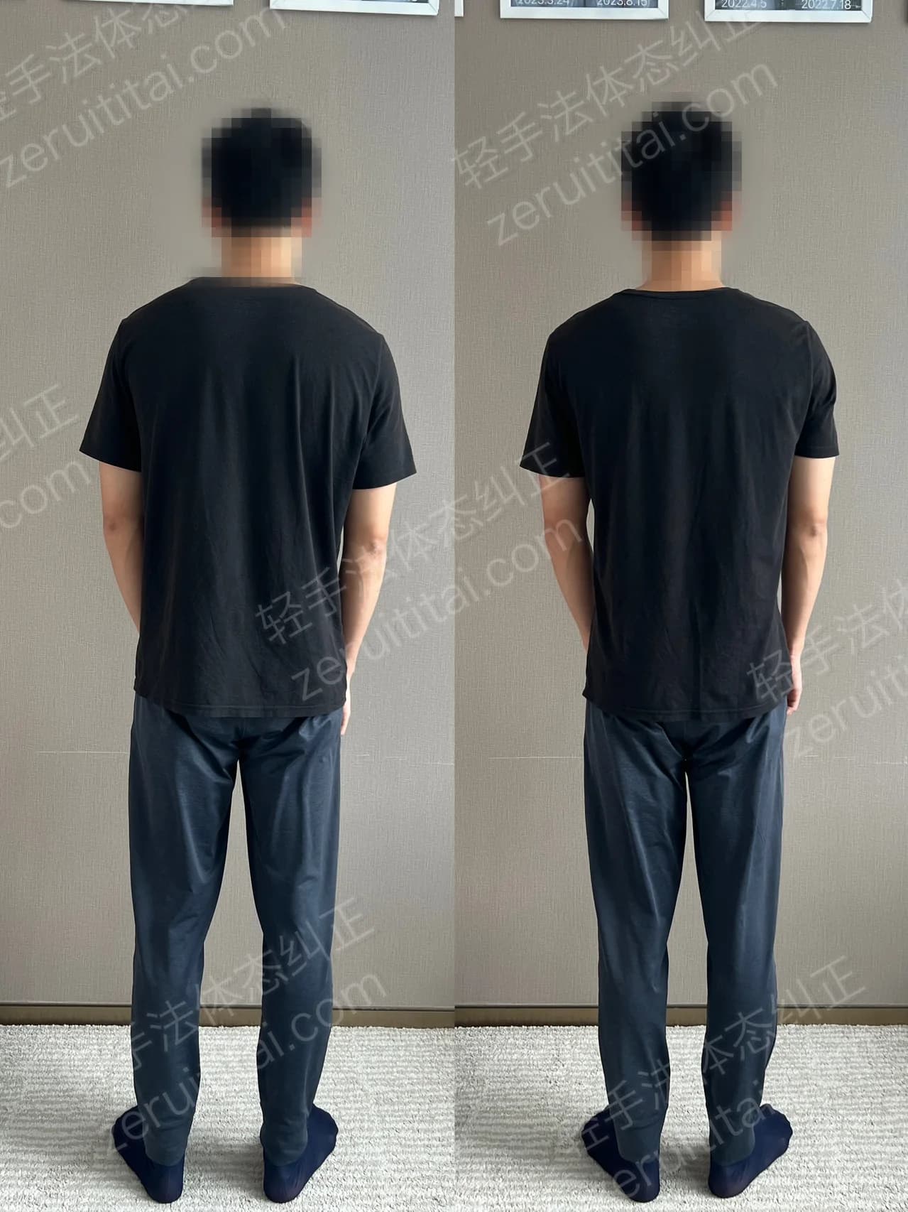 单次矫正案例对比 183