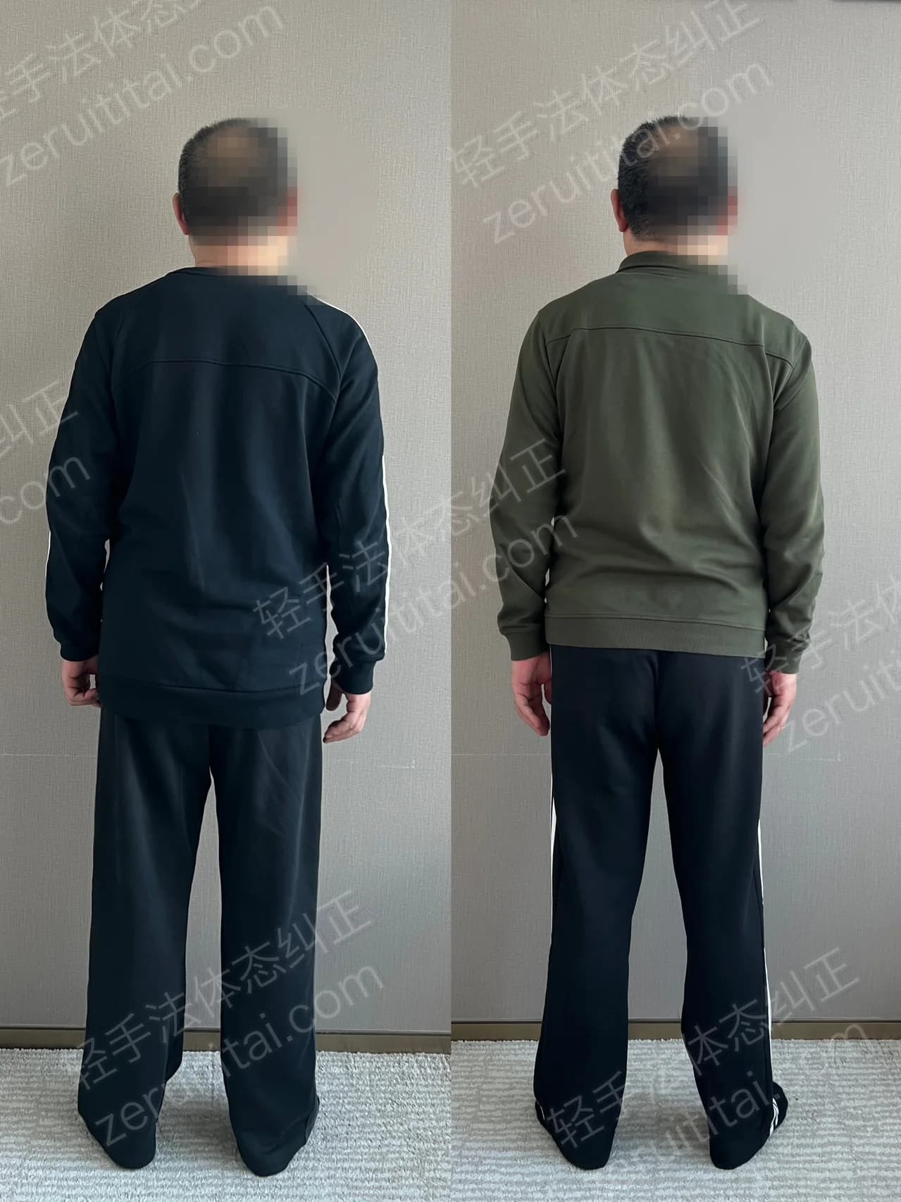 单次矫正案例对比 186