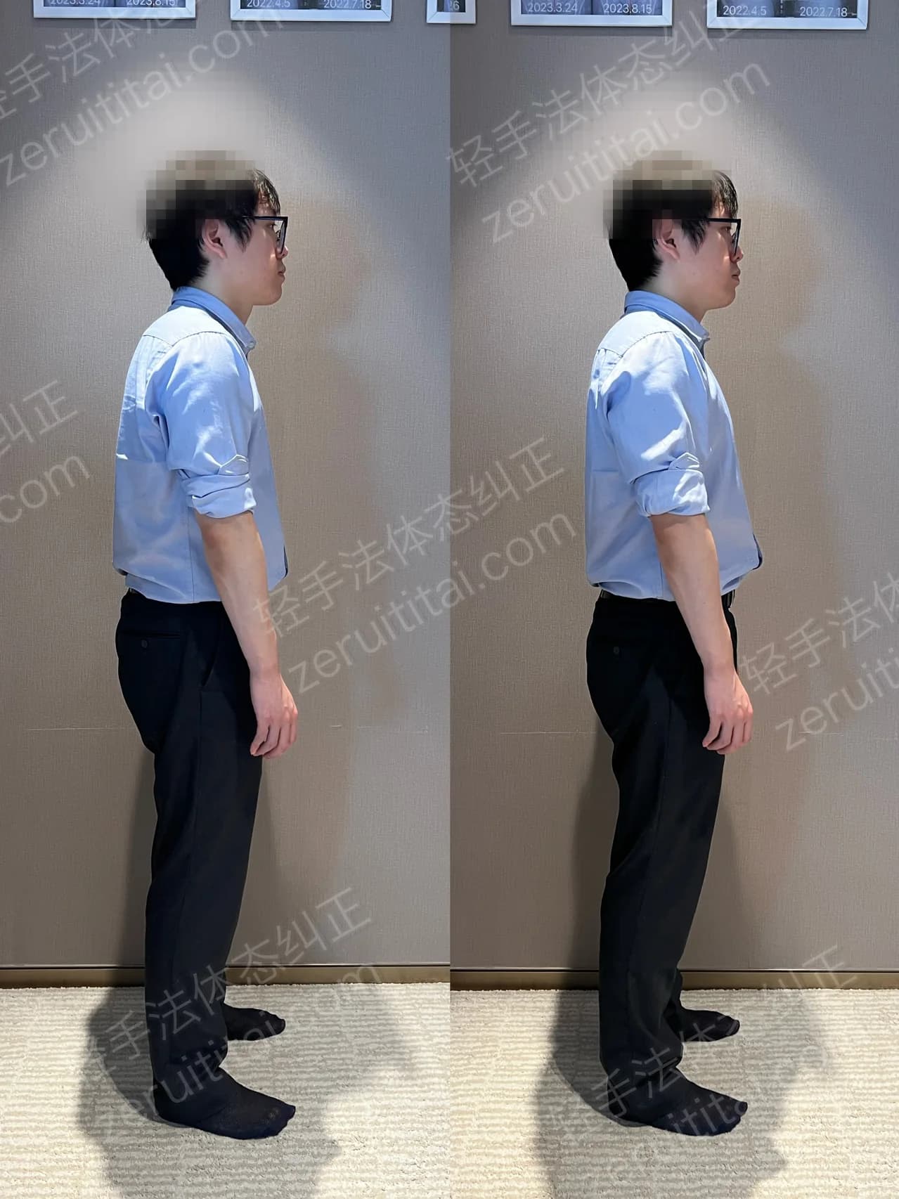 单次矫正案例对比 189