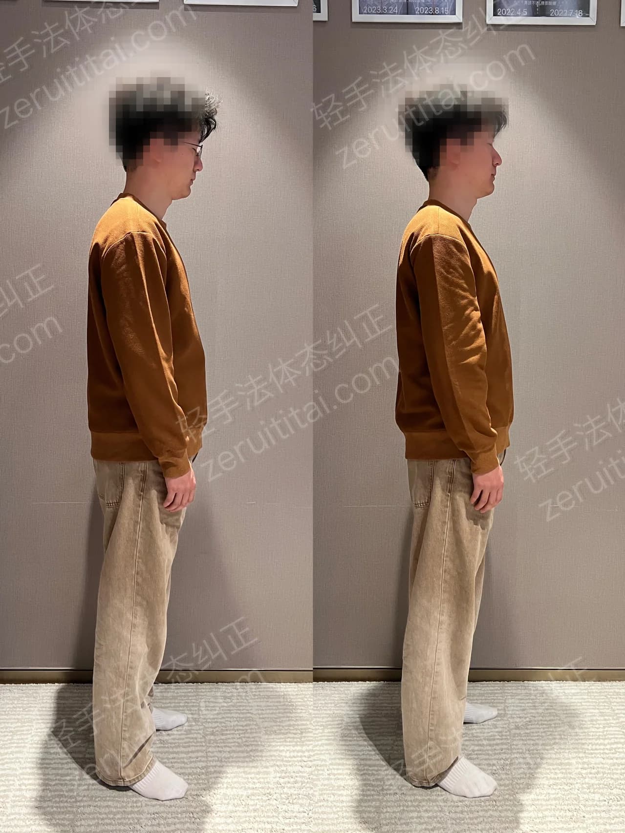 单次矫正案例对比 192