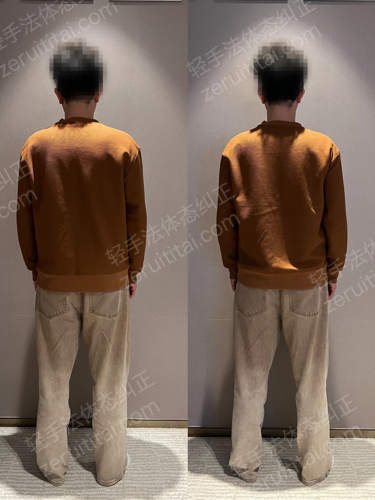 单次矫正案例对比 193