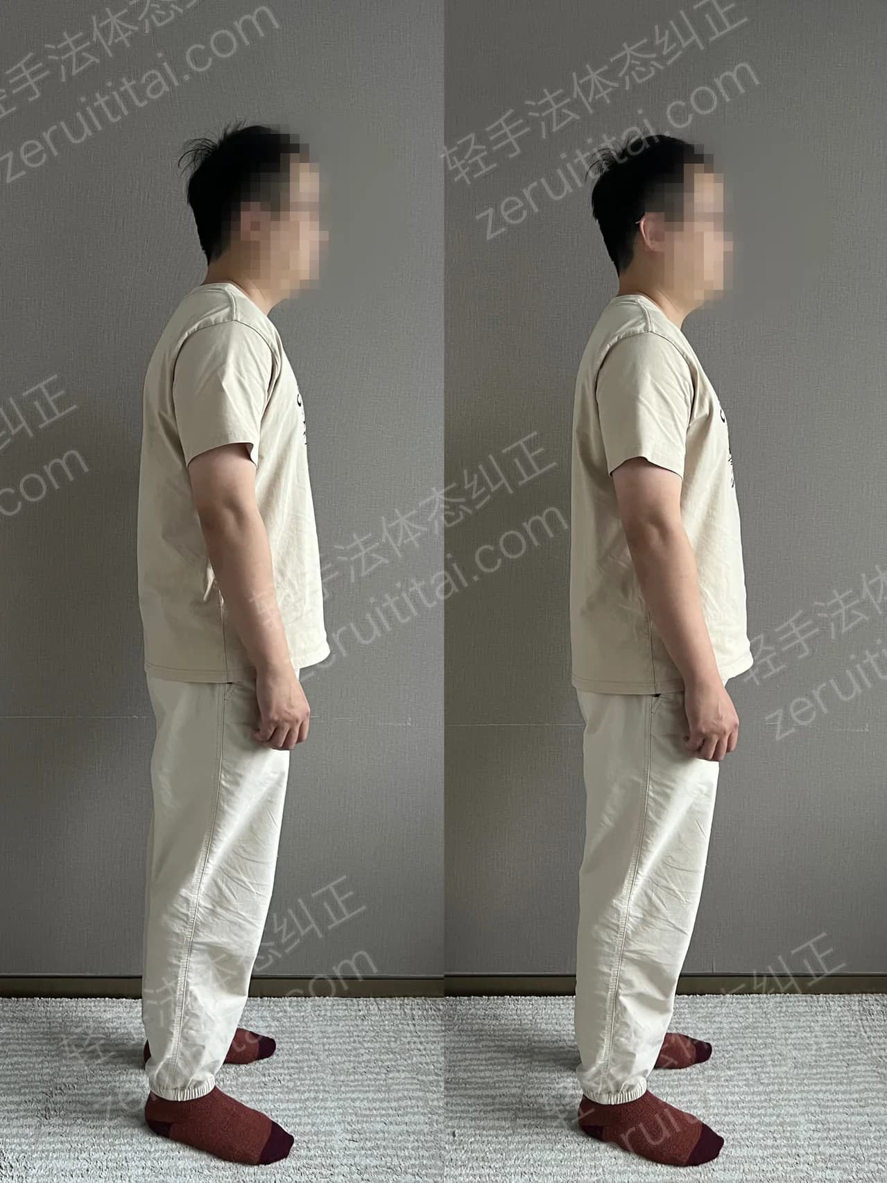 单次矫正案例对比 194