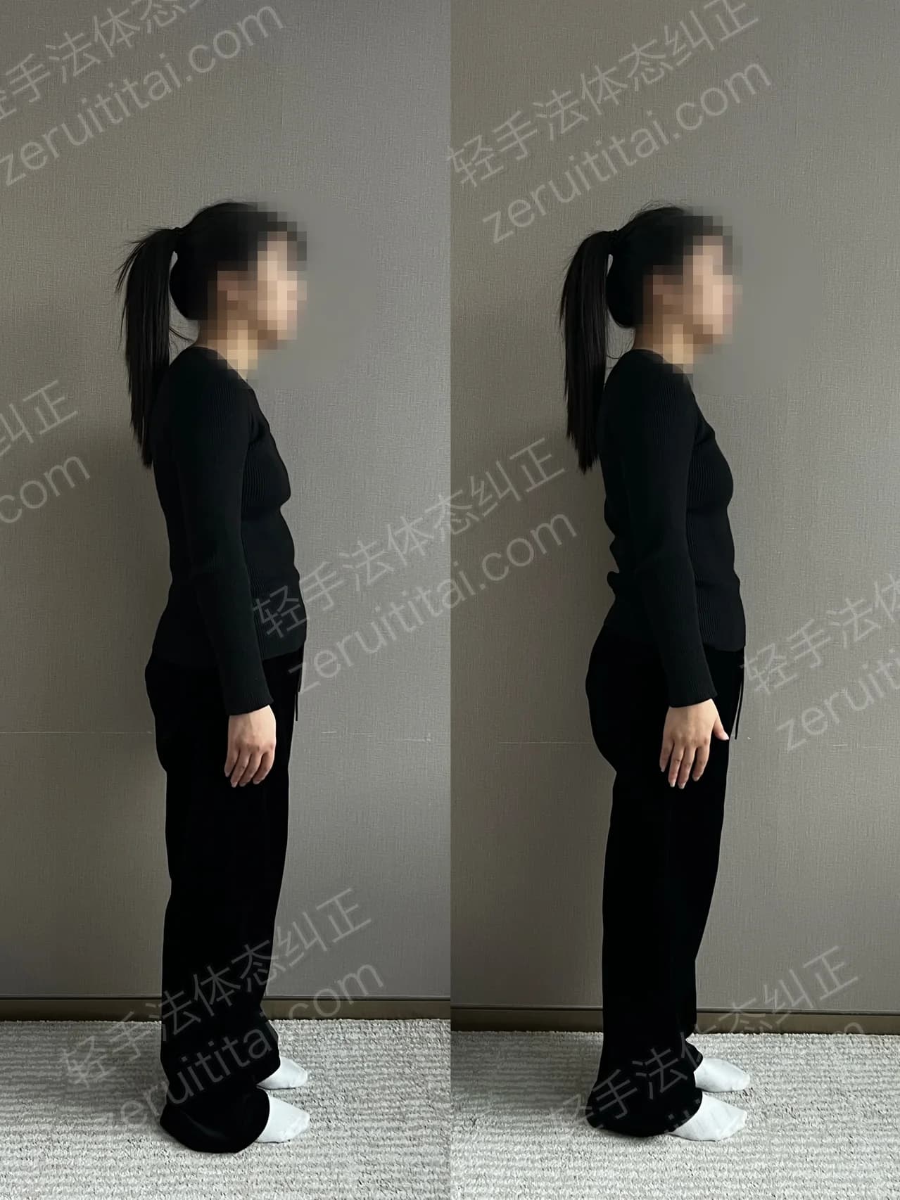 单次矫正案例对比 195