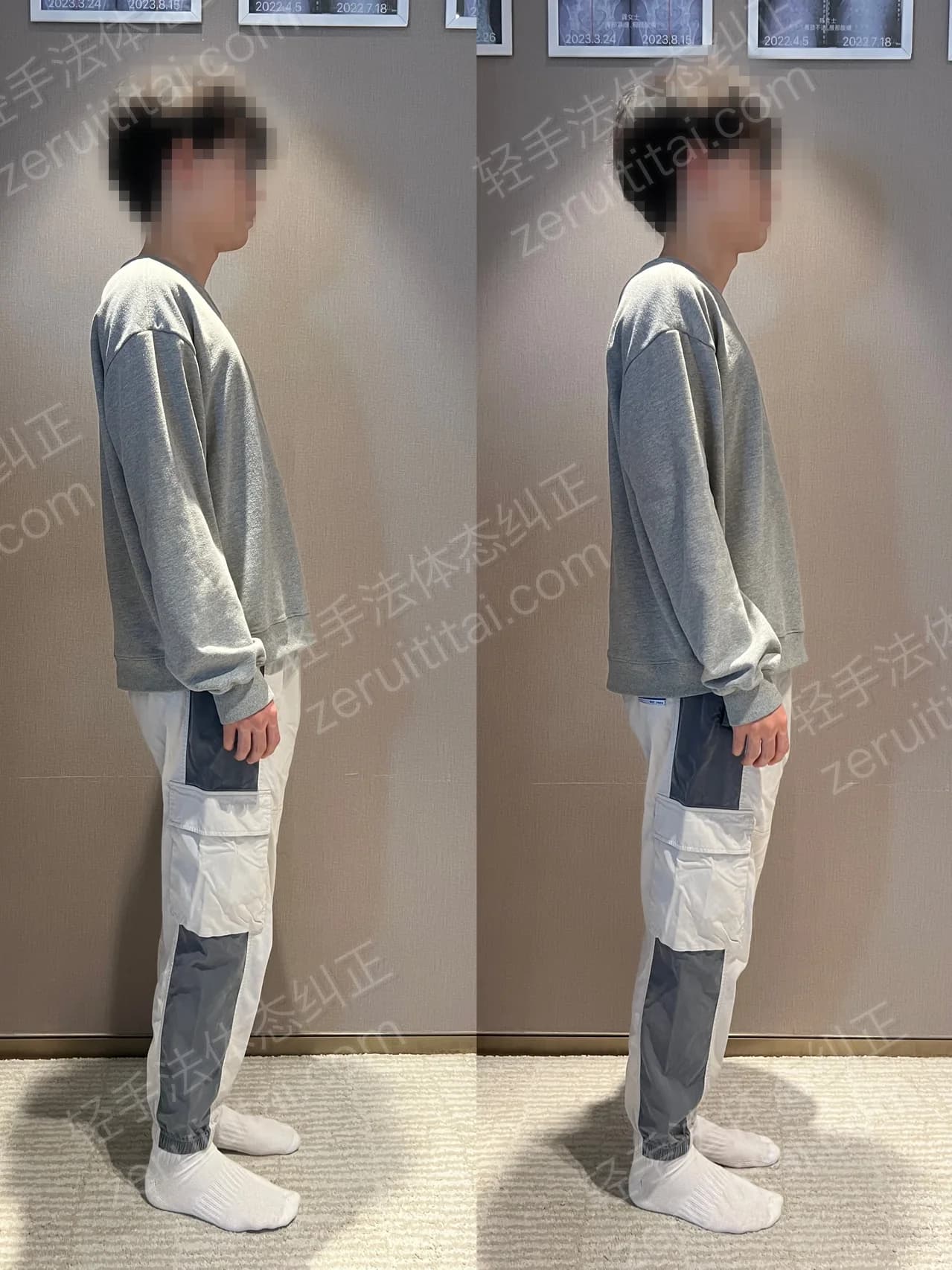 单次矫正案例对比 196
