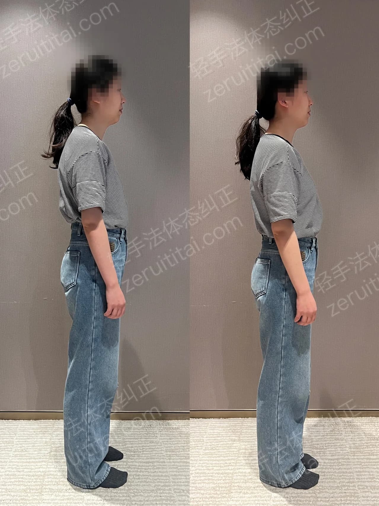 单次矫正案例对比 198