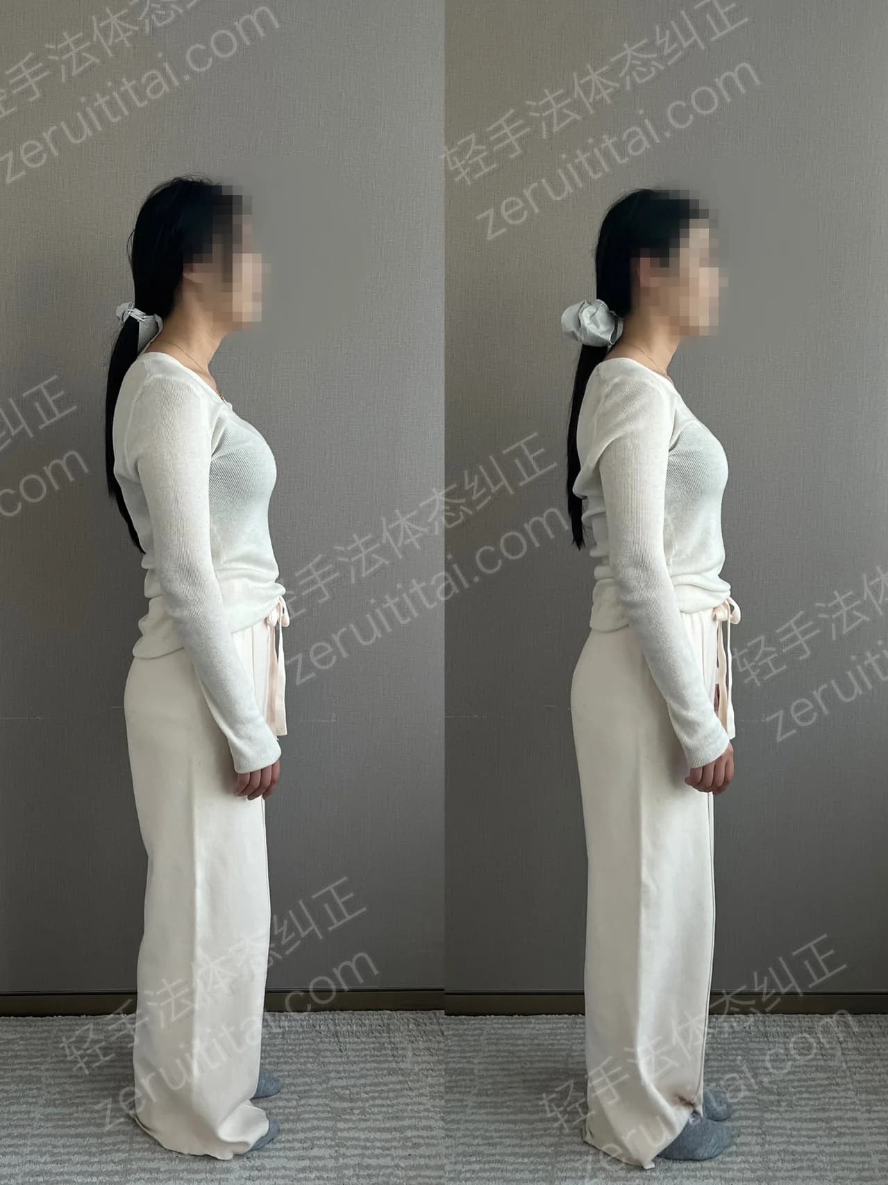 单次矫正案例对比 200