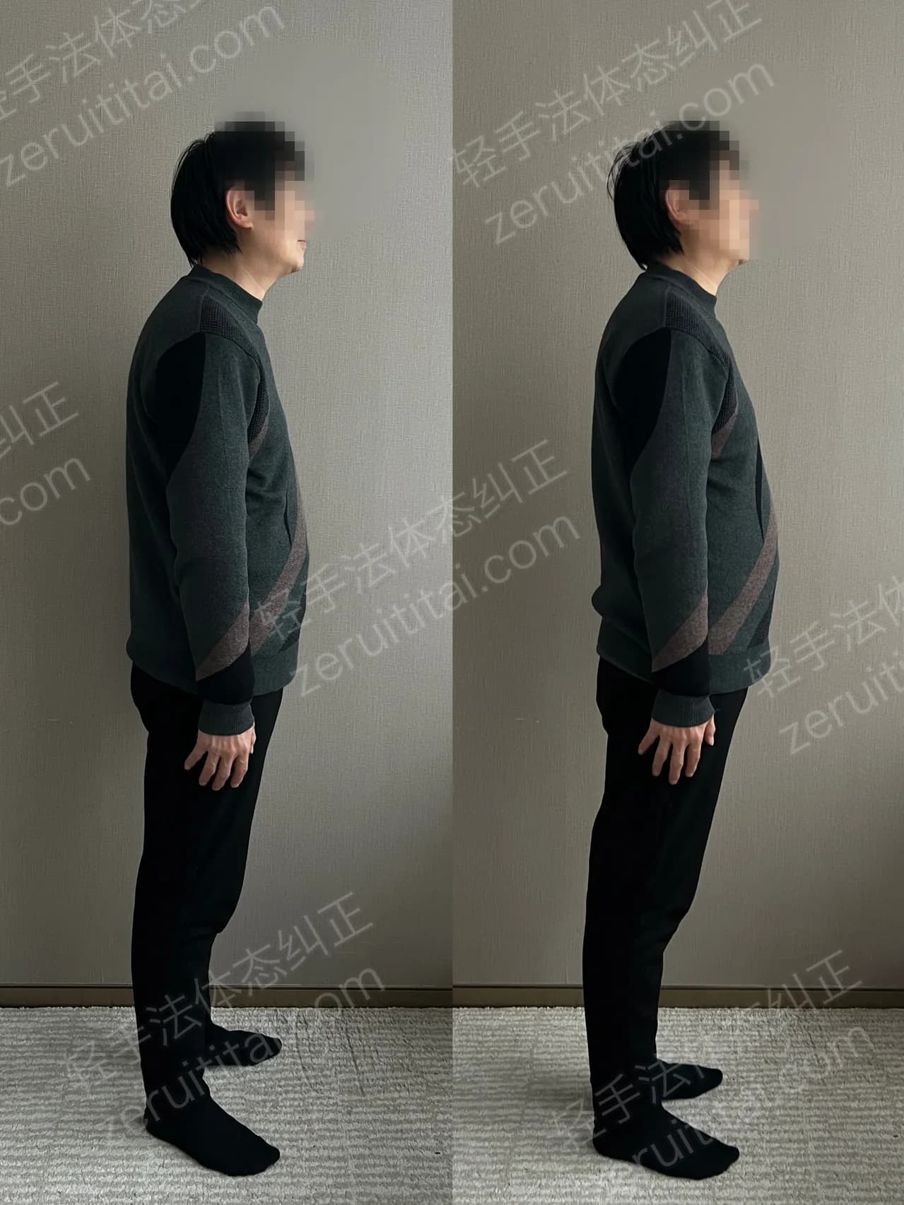 单次矫正案例对比 202