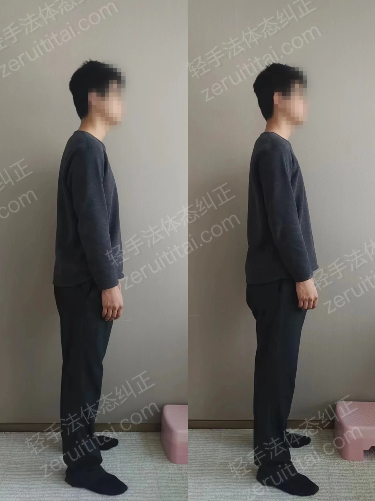 单次矫正案例对比 205