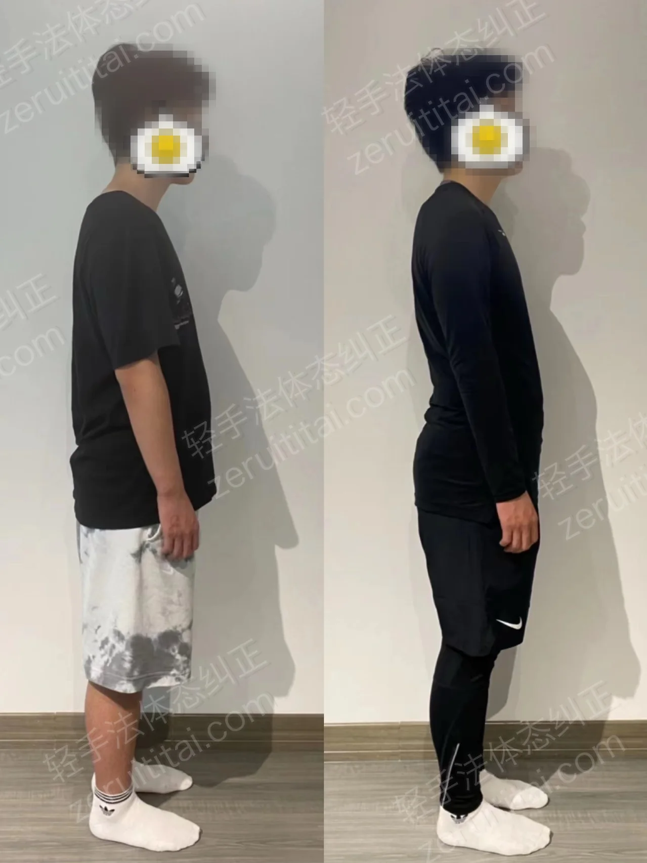 单次矫正案例对比 207