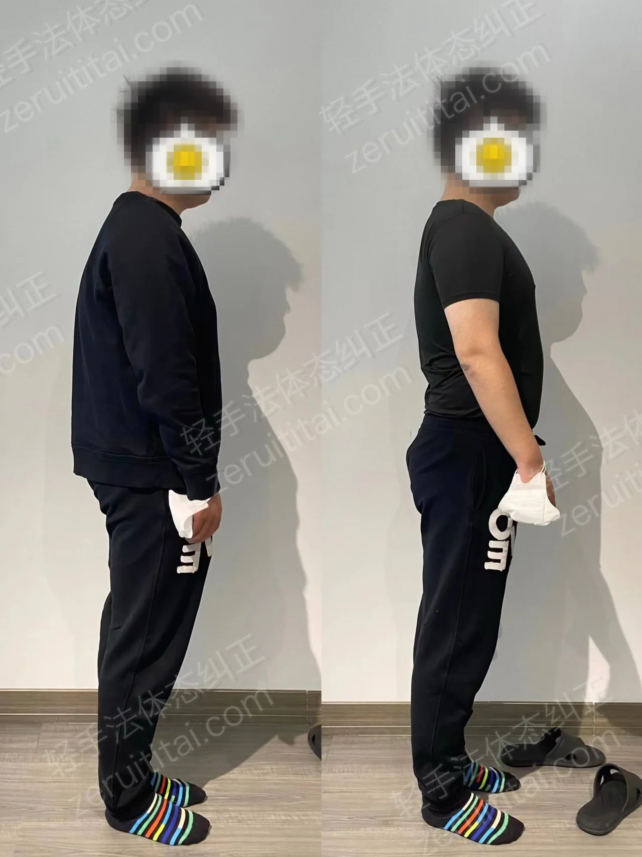 单次矫正案例对比 209