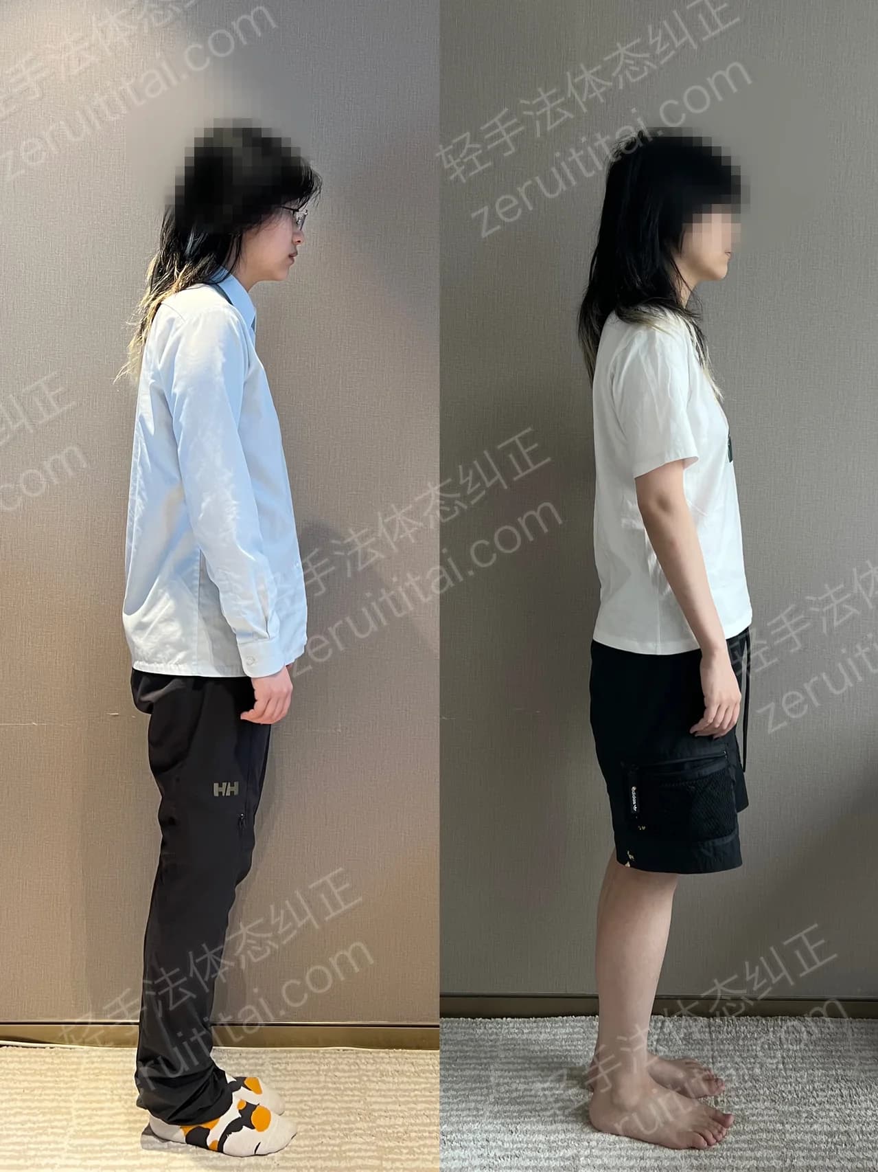 单次矫正案例对比 210