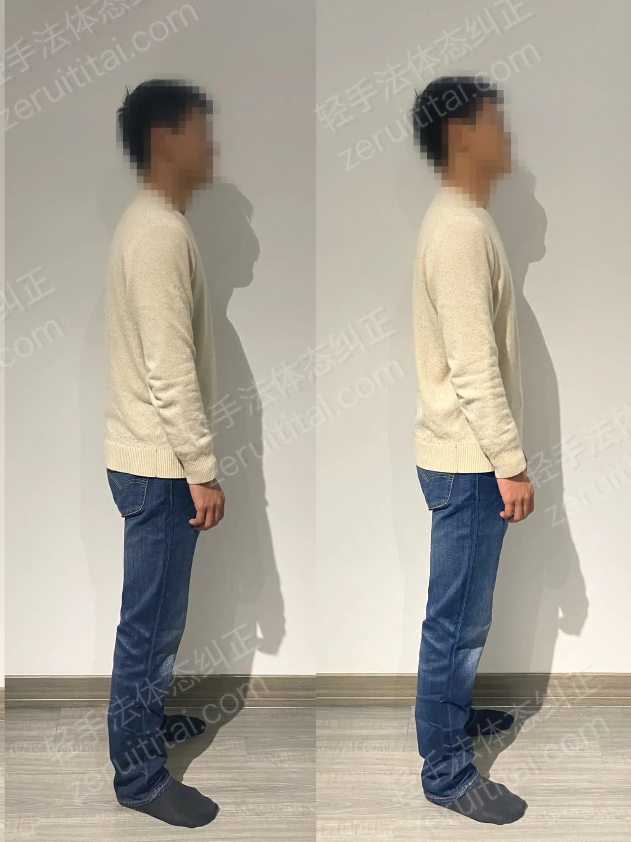 单次矫正案例对比 212
