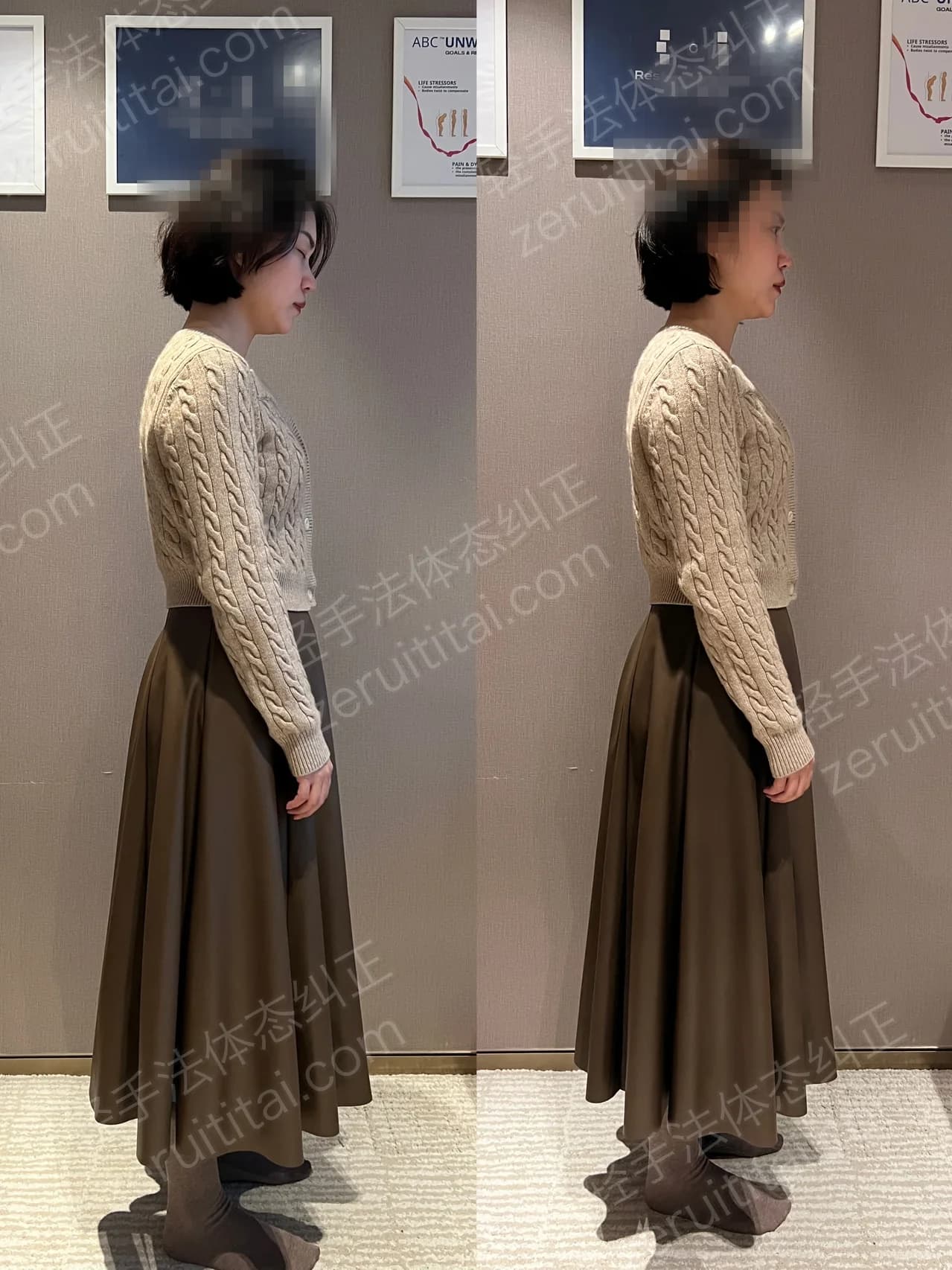 单次矫正案例对比 214