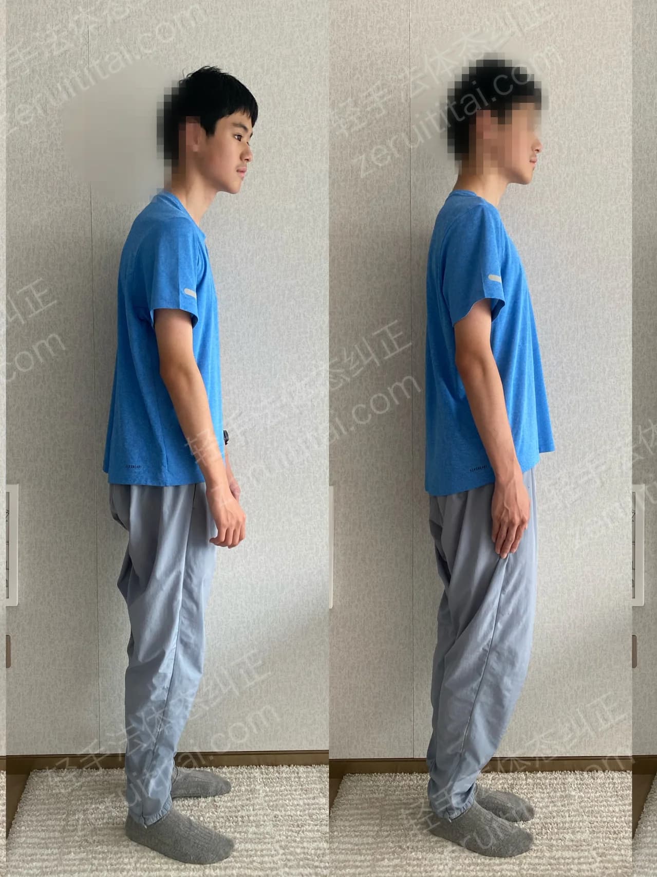 单次矫正案例对比 217