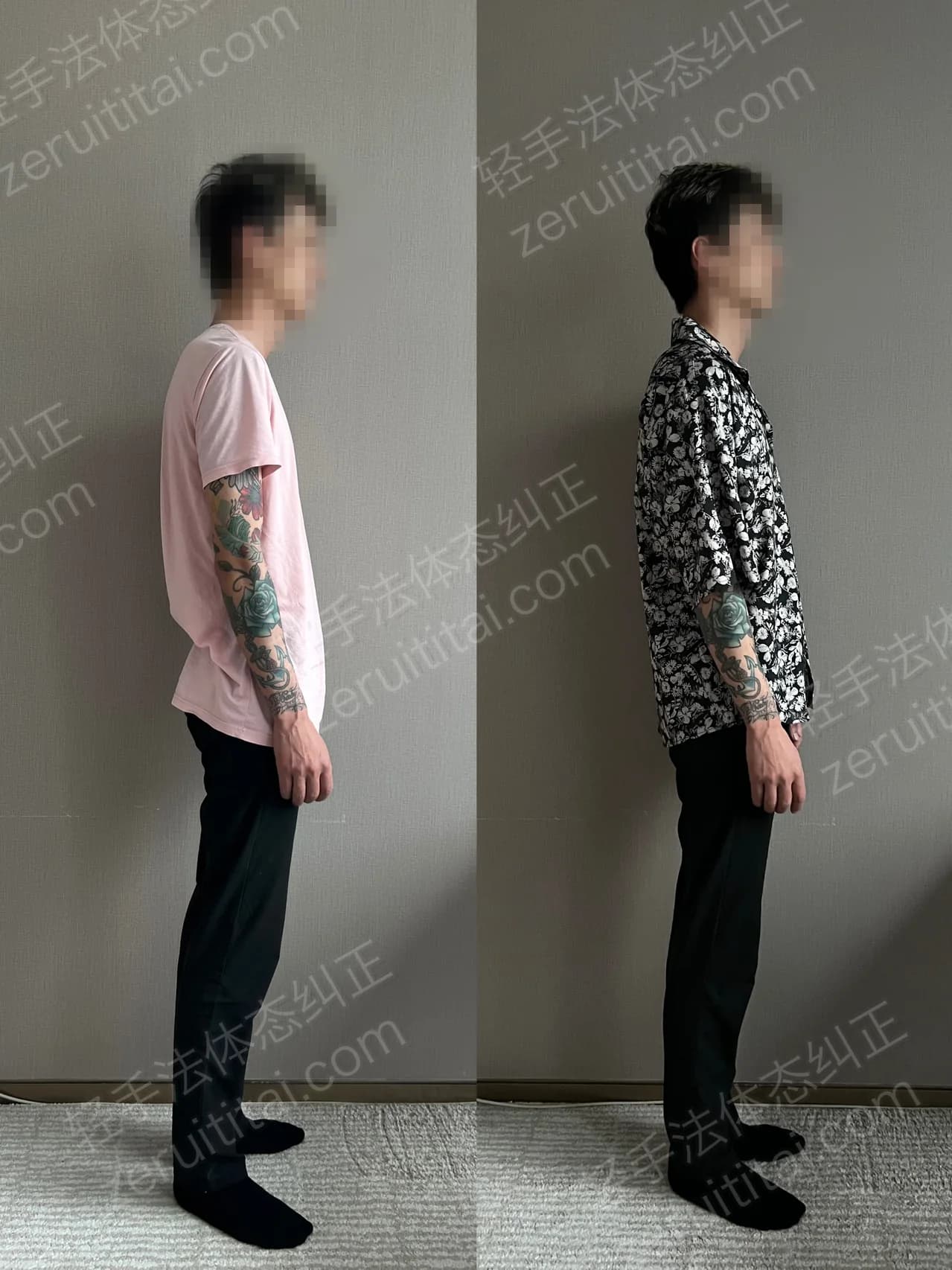 单次矫正案例对比 218