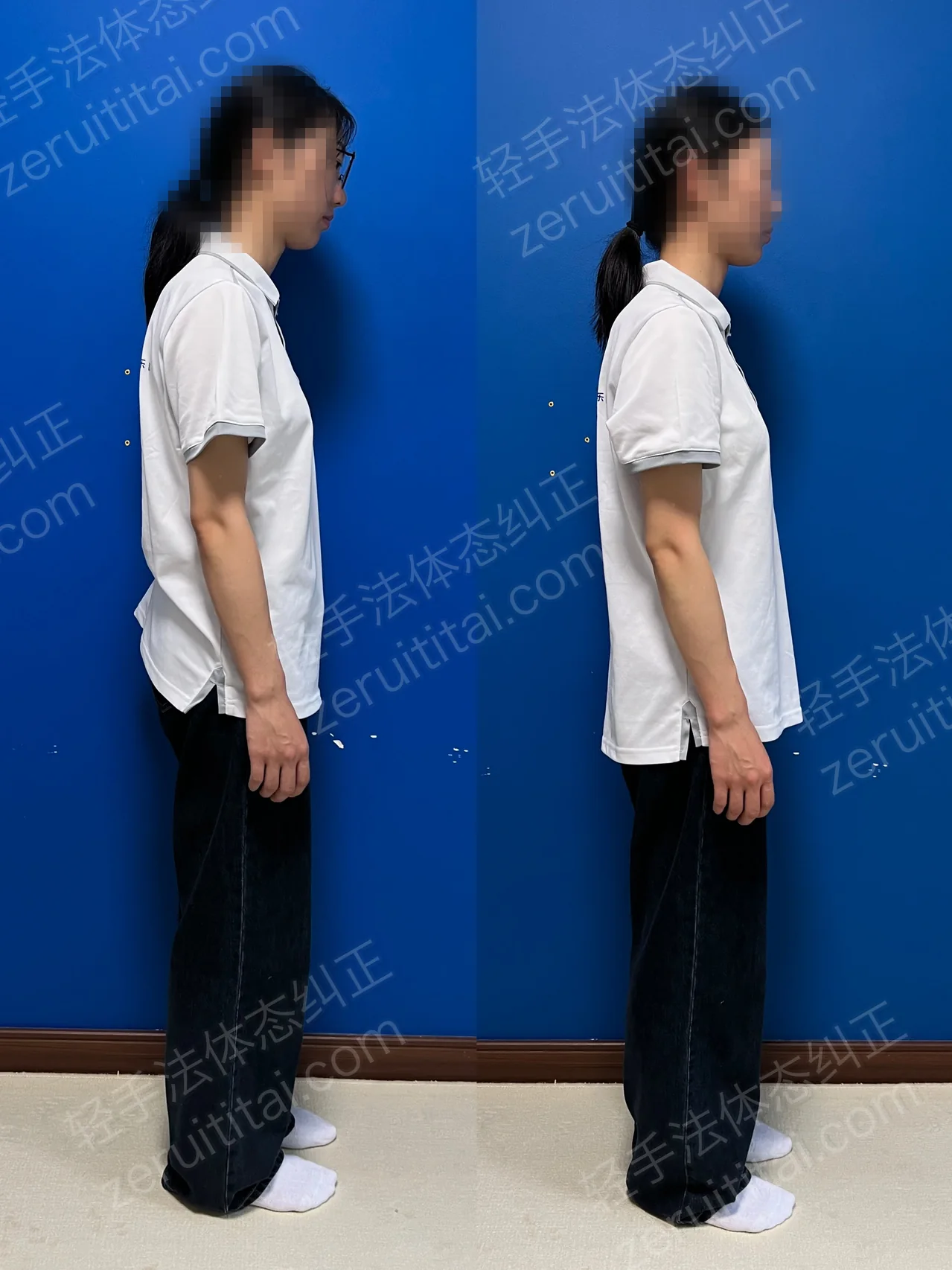 单次矫正案例对比 219