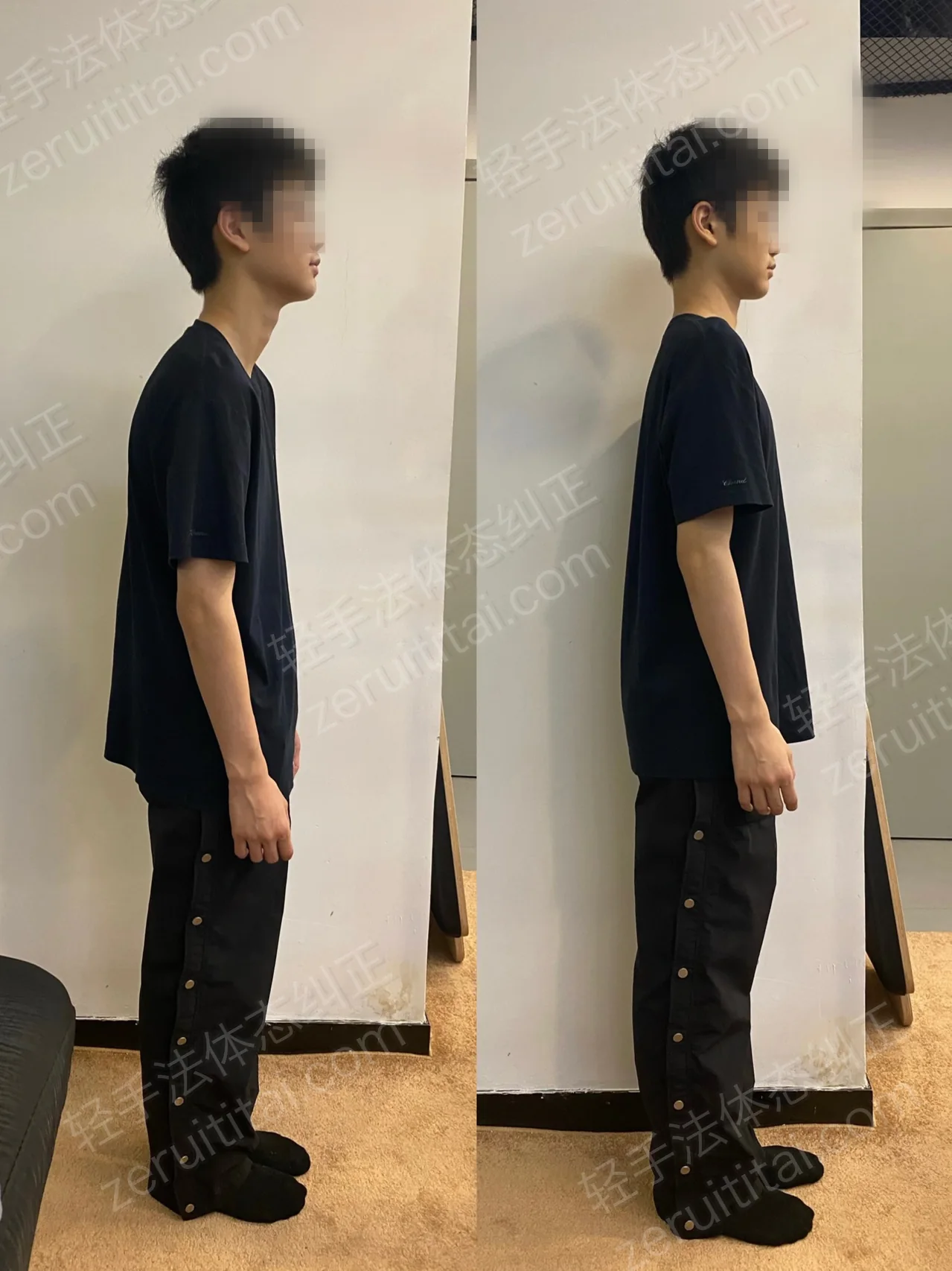 单次矫正案例对比 220