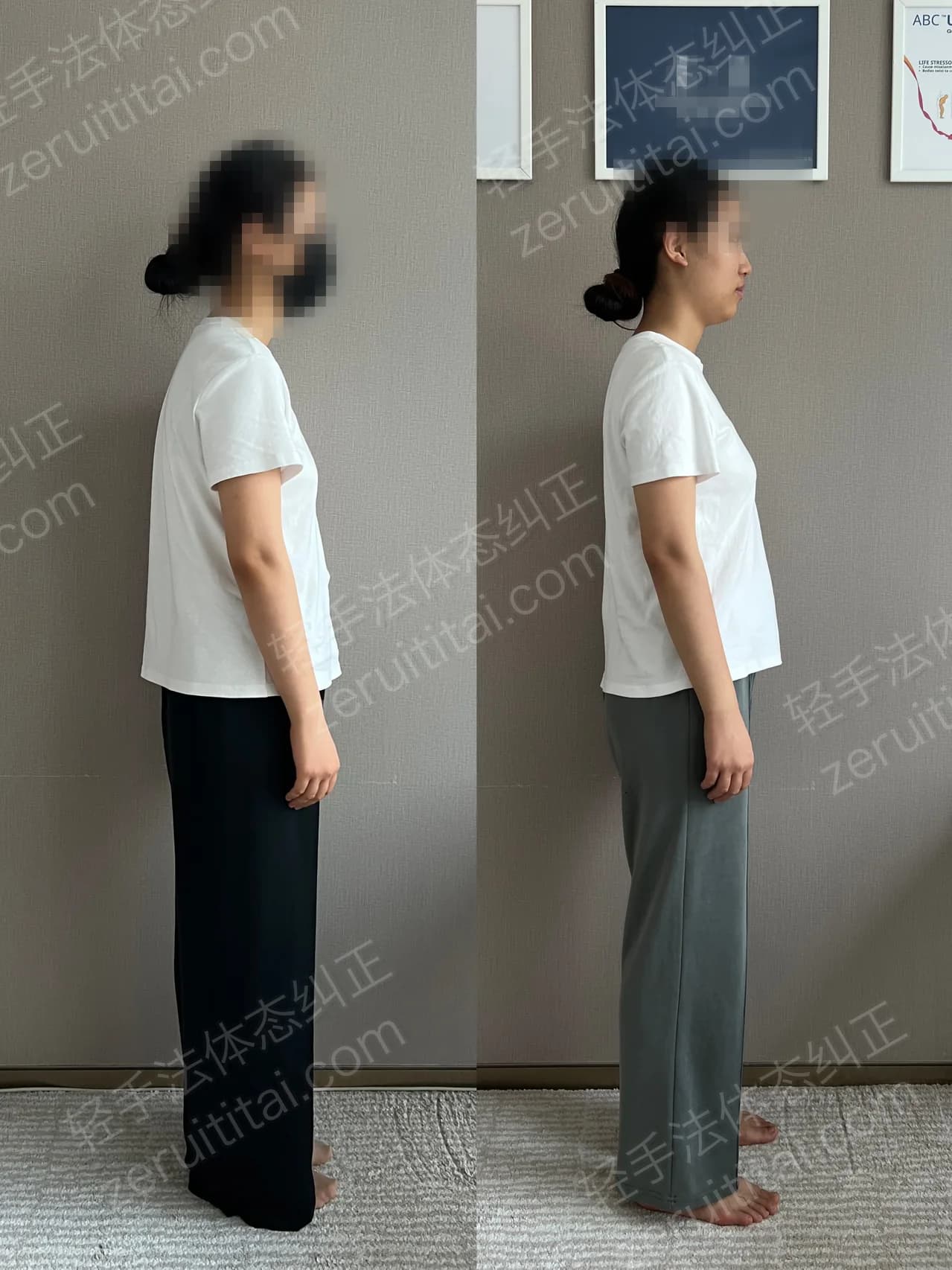 单次矫正案例对比 221