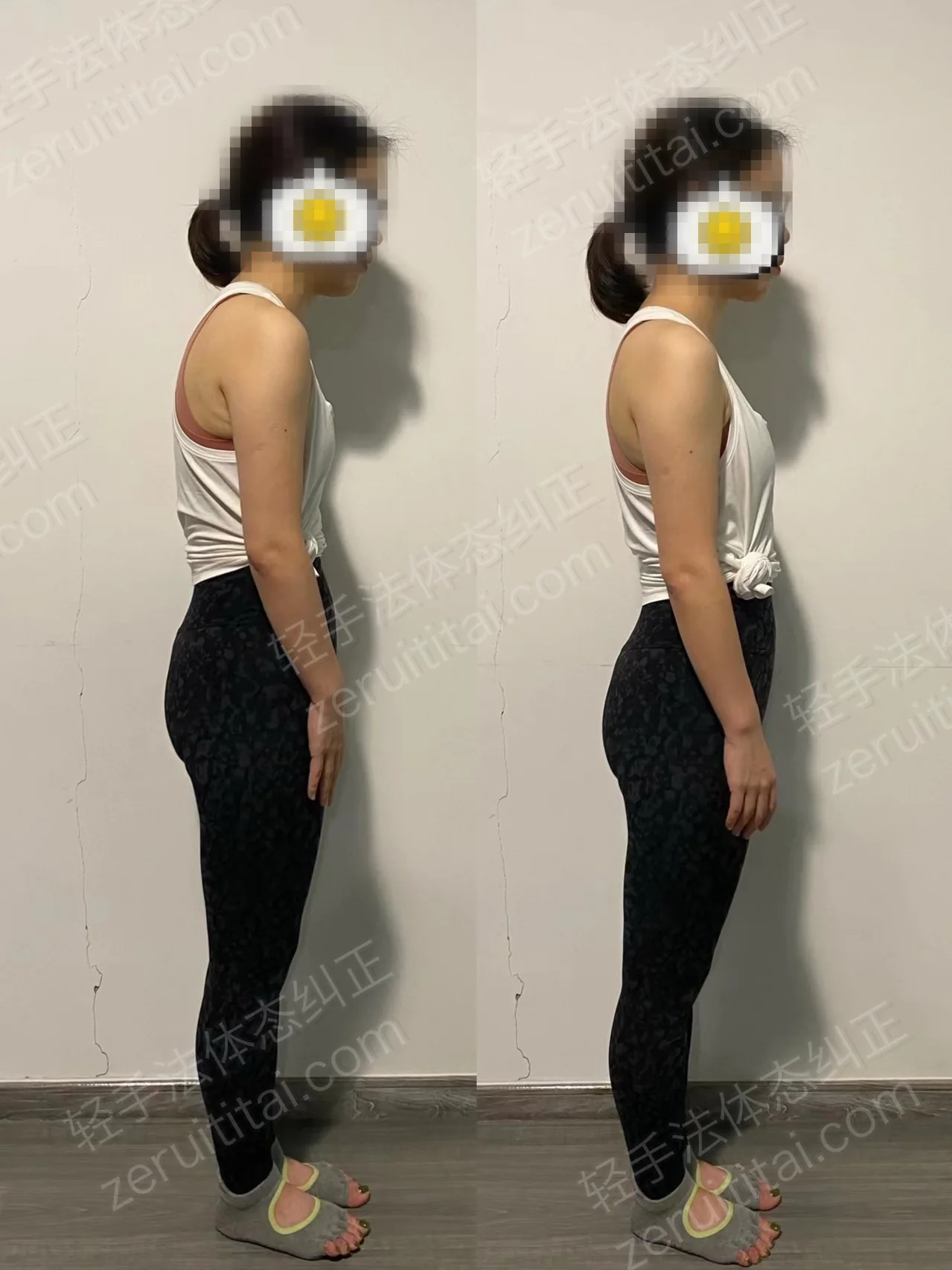 单次矫正案例对比 224