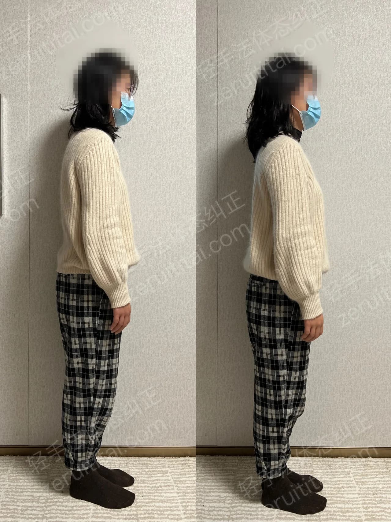 单次矫正案例对比 225